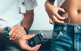 Plano de Saúde Deve Cobrir Bomba de Insulina para Paciente com Diabetes?