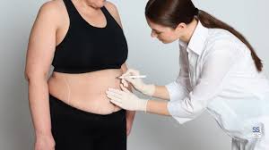 Direito à Cobertura de Cirurgias Bariátricas pelos Planos de Saúde