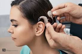 Cobertura de Cirurgia de Implante Coclear pelos Planos de Saúde